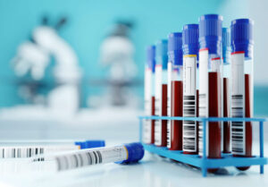 labeled blood collection tubes with barcodes arranged in a rack for cold chain processing